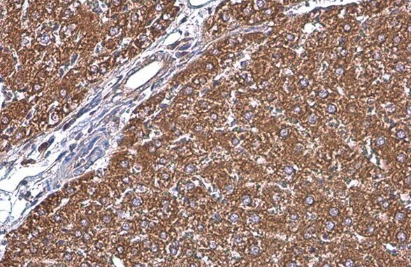 GRP78 Antibody in Immunohistochemistry (Paraffin) (IHC (P))