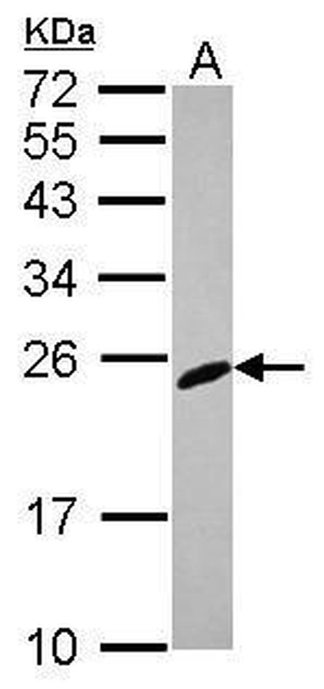 RGS2 Antibody in Western Blot (WB)