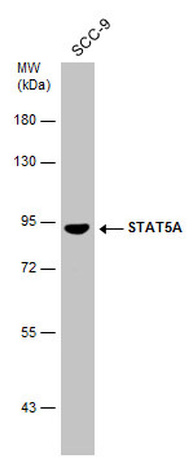 STAT5 alpha Antibody in Western Blot (WB)