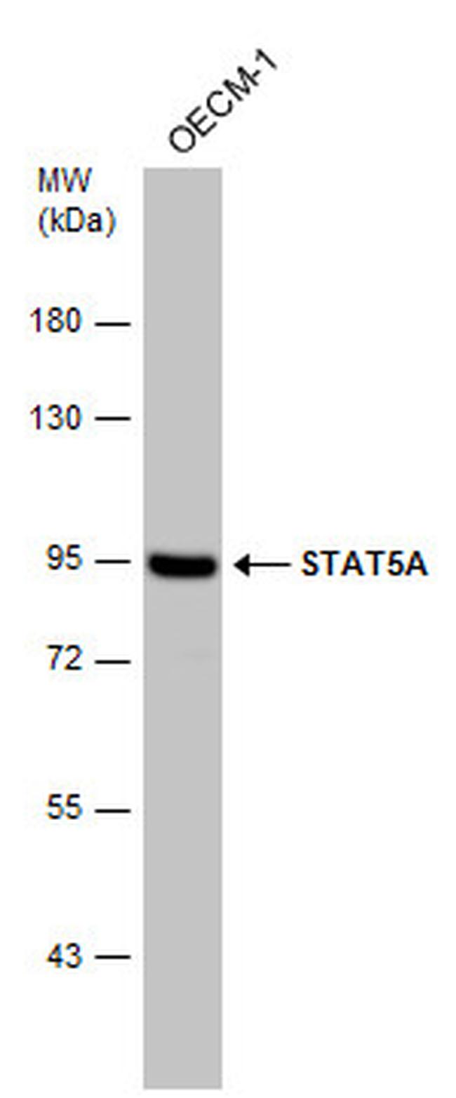 STAT5 alpha Antibody in Western Blot (WB)