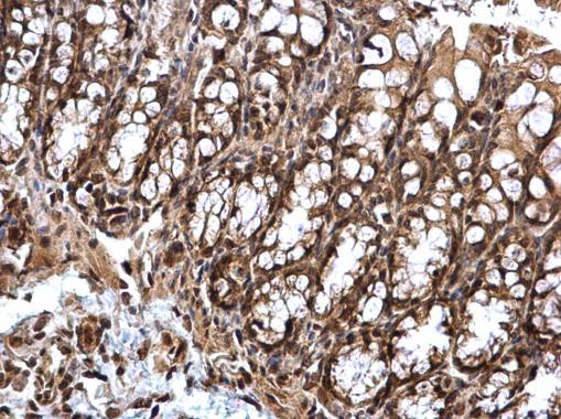 STAT5 alpha Antibody in Immunohistochemistry (Paraffin) (IHC (P))