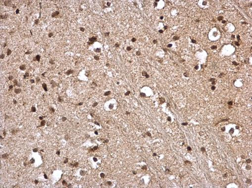 STAT5 alpha Antibody in Immunohistochemistry (Paraffin) (IHC (P))