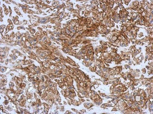 CD99 Antibody in Immunohistochemistry (Paraffin) (IHC (P))