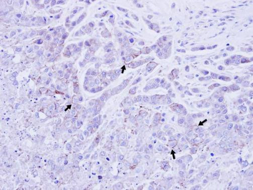 ATP1B1 Antibody in Immunohistochemistry (Paraffin) (IHC (P))