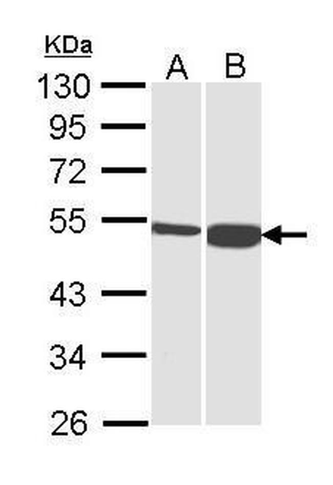 DBT Antibody in Western Blot (WB)