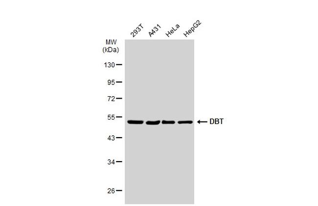 DBT Antibody in Western Blot (WB)