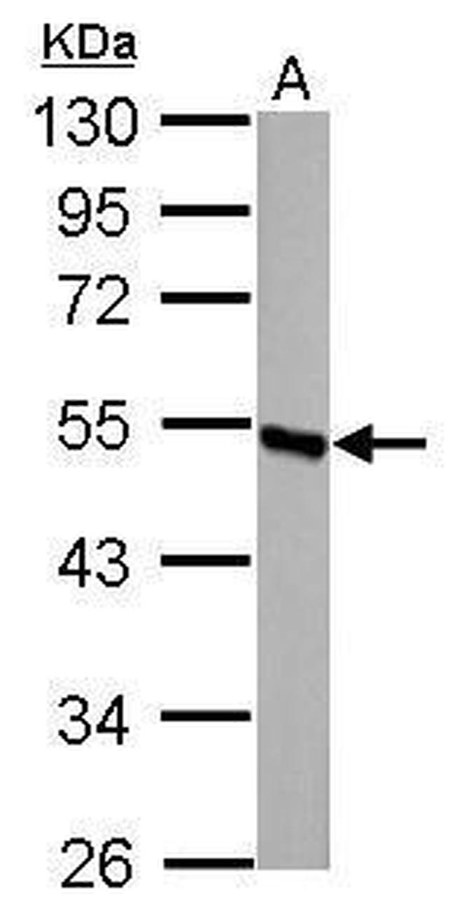 DBT Antibody in Western Blot (WB)