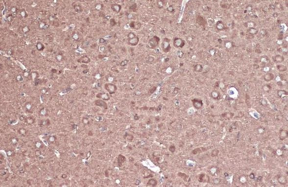 CRMP2 Antibody in Immunohistochemistry (Paraffin) (IHC (P))