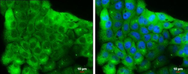 NSE Antibody in Immunocytochemistry (ICC/IF)