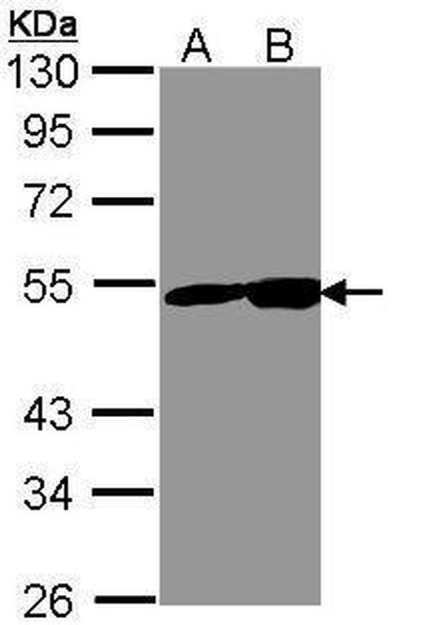 NSE Antibody in Western Blot (WB)