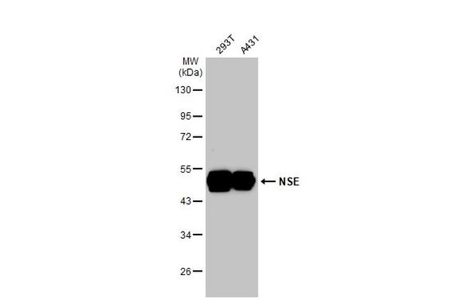 NSE Antibody in Western Blot (WB)