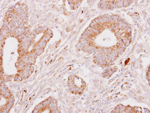 Fibrinogen gamma Antibody in Immunohistochemistry (Paraffin) (IHC (P))