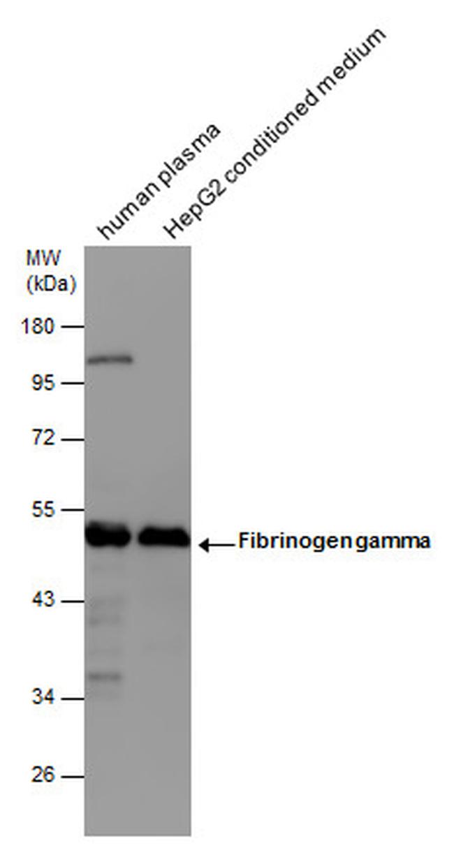 Fibrinogen gamma Antibody in Western Blot (WB)