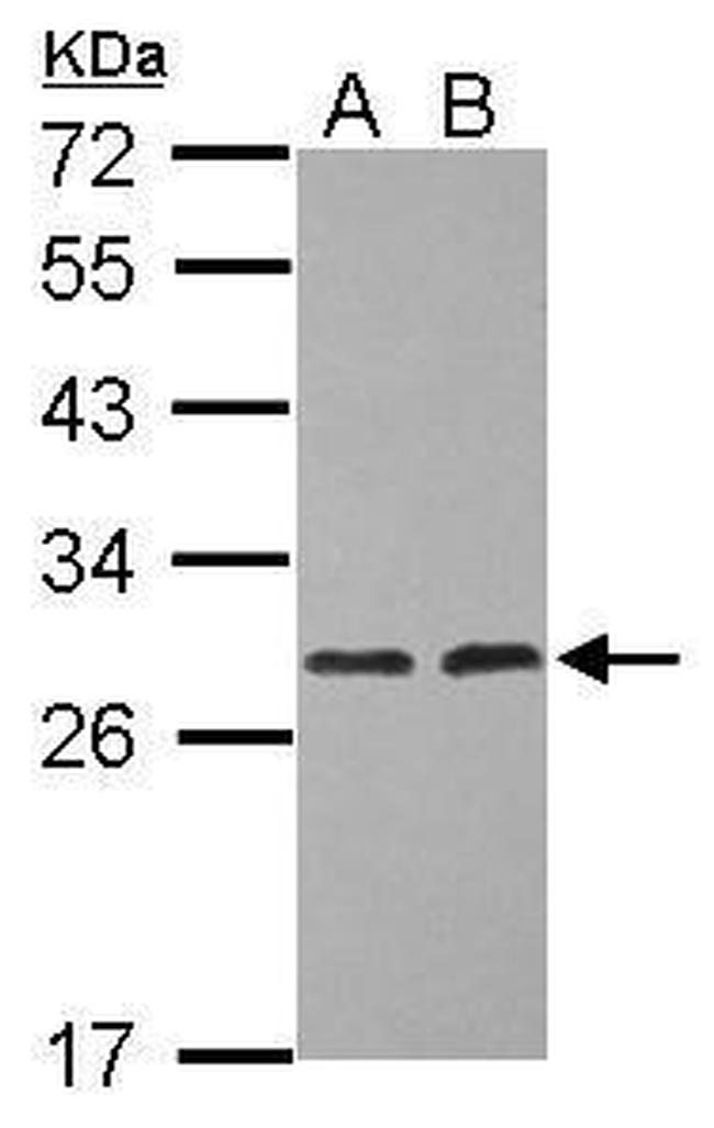 ERAB Antibody in Western Blot (WB)