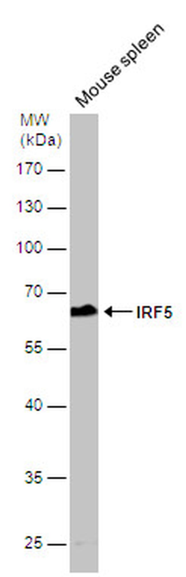 IRF5 Antibody in Western Blot (WB)