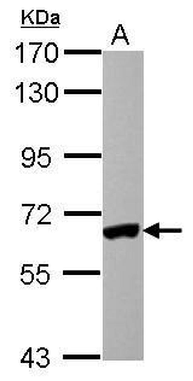 IRF5 Antibody in Western Blot (WB)