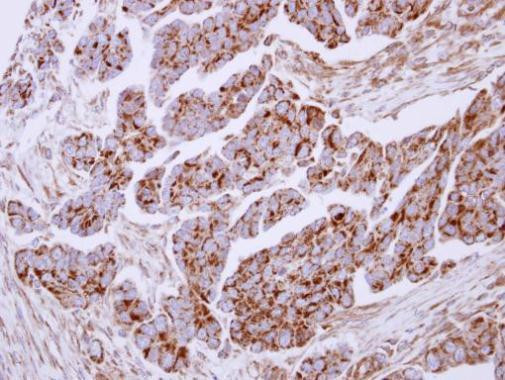 Lactoferrin Antibody in Immunohistochemistry (Paraffin) (IHC (P))