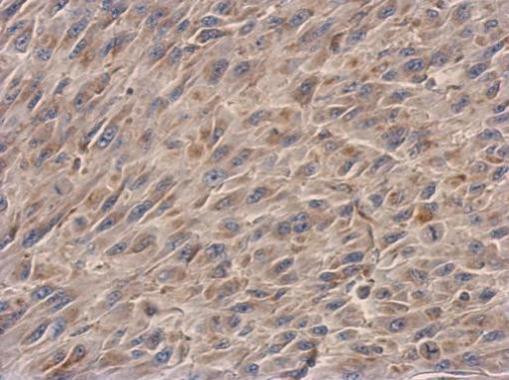 NDUFS3 Antibody in Immunohistochemistry (Paraffin) (IHC (P))