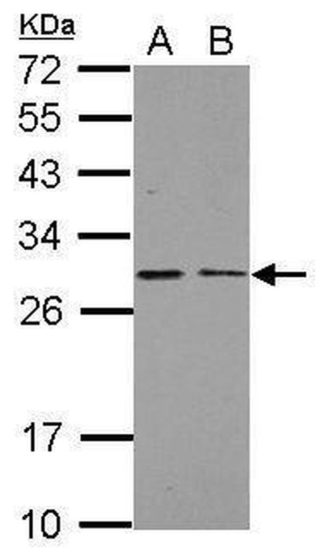 NDUFS3 Antibody in Western Blot (WB)