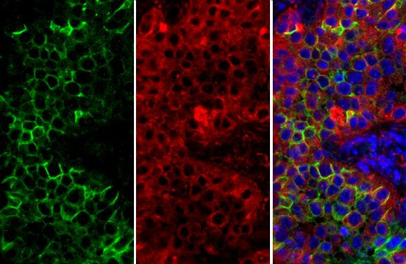 CD73 Antibody in Immunohistochemistry (Paraffin) (IHC (P))