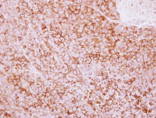 CD73 Antibody in Immunohistochemistry (Paraffin) (IHC (P))