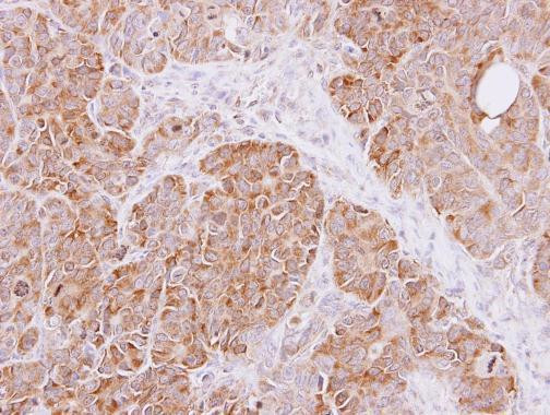 Cyclophilin A Antibody in Immunohistochemistry (Paraffin) (IHC (P))