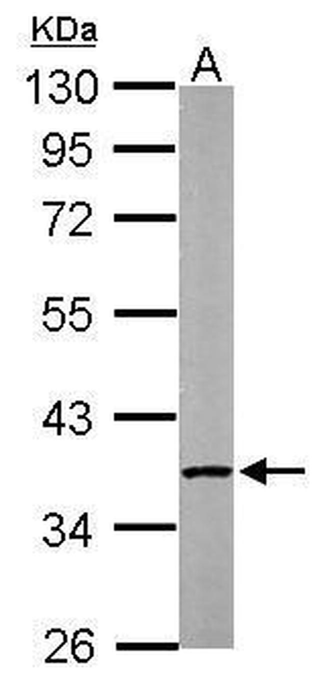 PP2A alpha Antibody in Western Blot (WB)