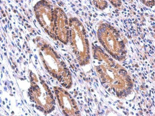 Nectin 2 Antibody in Immunohistochemistry (Paraffin) (IHC (P))