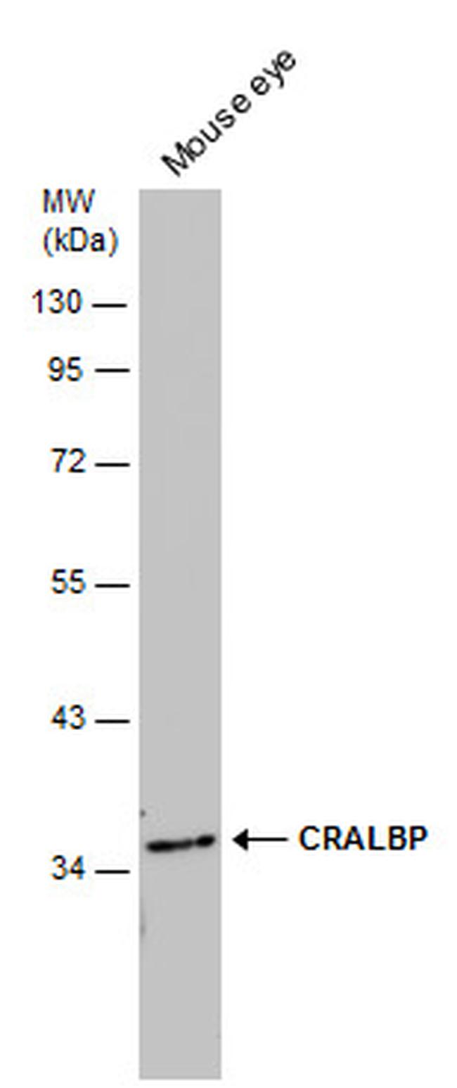 CRALBP Antibody in Western Blot (WB)