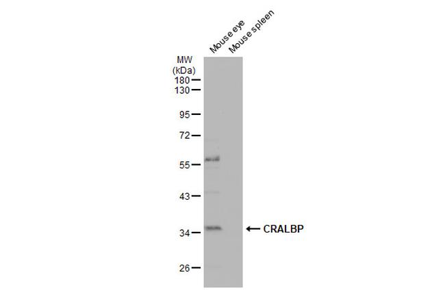 CRALBP Antibody in Western Blot (WB)