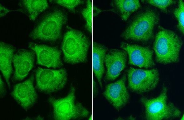 S6 Antibody in Immunocytochemistry (ICC/IF)