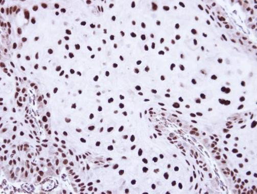 SSB Antibody in Immunohistochemistry (Paraffin) (IHC (P))