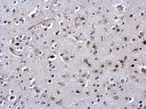 SSB Antibody in Immunohistochemistry (Paraffin) (IHC (P))