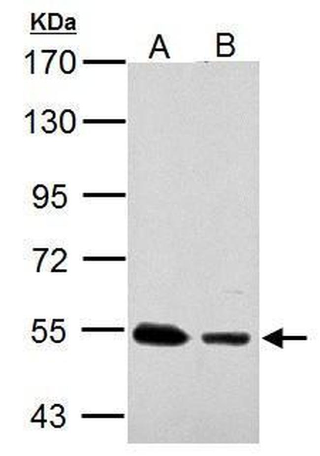 SSB Antibody in Western Blot (WB)