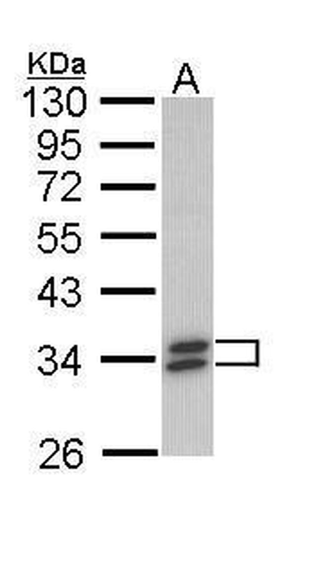 SULT1A1 Antibody in Western Blot (WB)