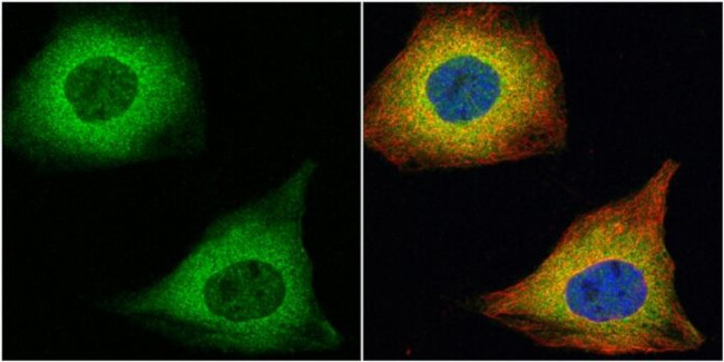 TAGLN Antibody in Immunocytochemistry (ICC/IF)