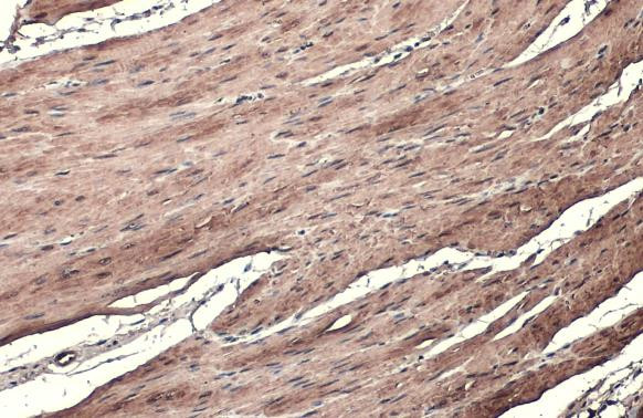 TAGLN Antibody in Immunohistochemistry (Paraffin) (IHC (P))