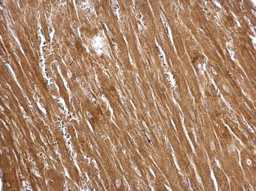 TAGLN Antibody in Immunohistochemistry (Paraffin) (IHC (P))