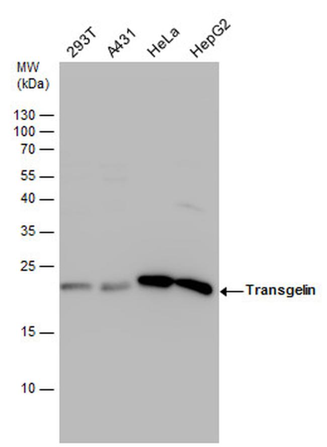 TAGLN Antibody in Western Blot (WB)