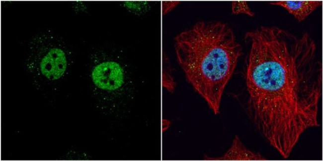 LXR beta Antibody in Immunocytochemistry (ICC/IF)