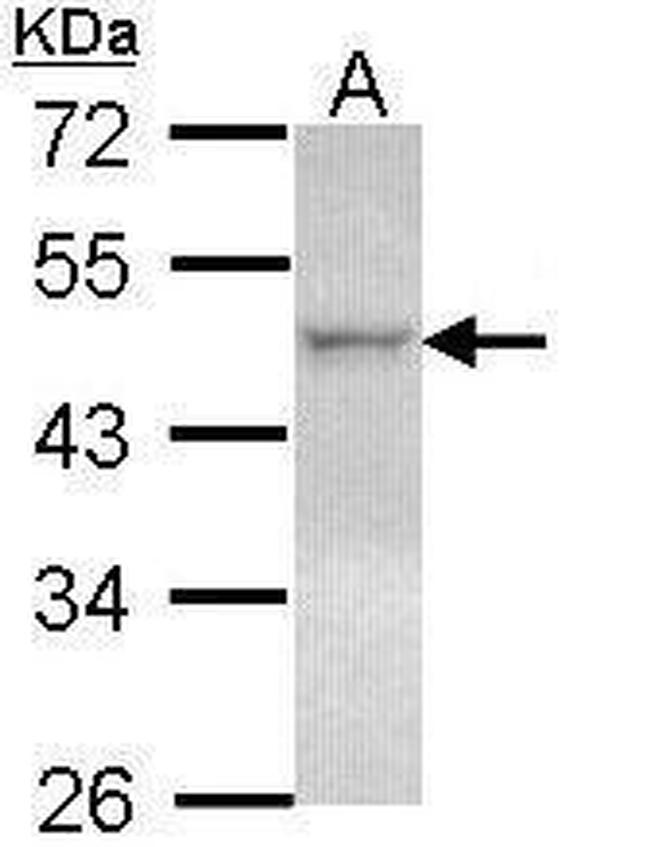 LXR beta Antibody in Western Blot (WB)