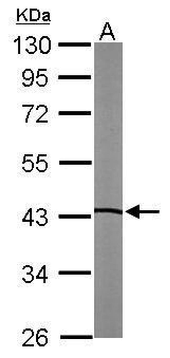 LXR beta Antibody in Western Blot (WB)