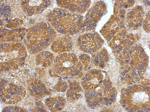 VEGFC Antibody in Immunohistochemistry (Paraffin) (IHC (P))