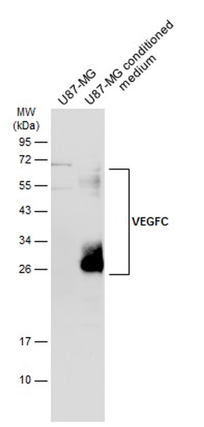 VEGFC Antibody in Western Blot (WB)