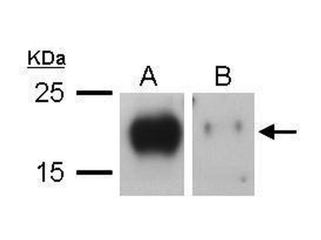 VEGFC Antibody in Western Blot (WB)