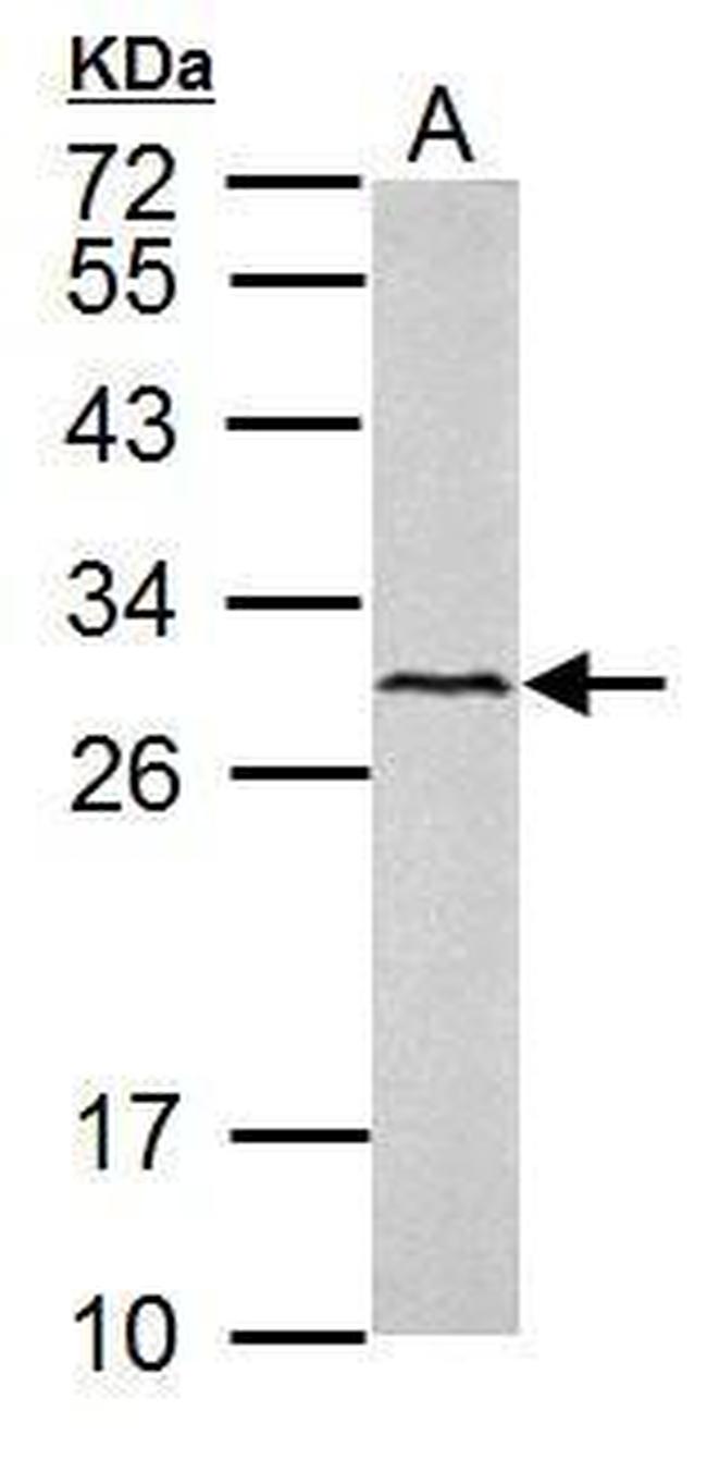 VEGFC Antibody in Western Blot (WB)