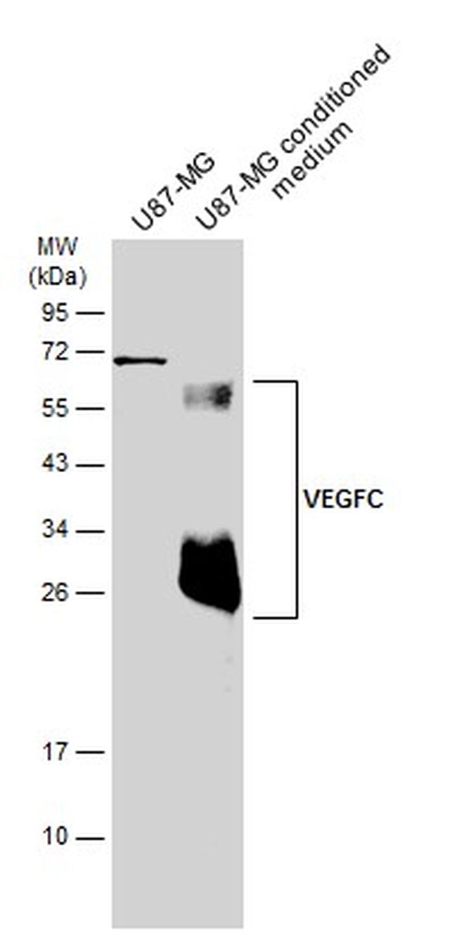 VEGFC Antibody in Western Blot (WB)