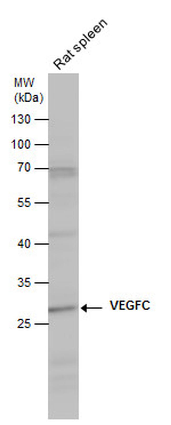 VEGFC Antibody in Western Blot (WB)