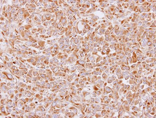 14-3-3 epsilon Antibody in Immunohistochemistry (Paraffin) (IHC (P))