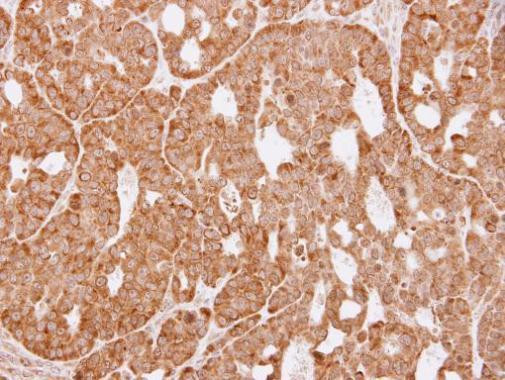 AKR1C3 Antibody in Immunohistochemistry (Paraffin) (IHC (P))